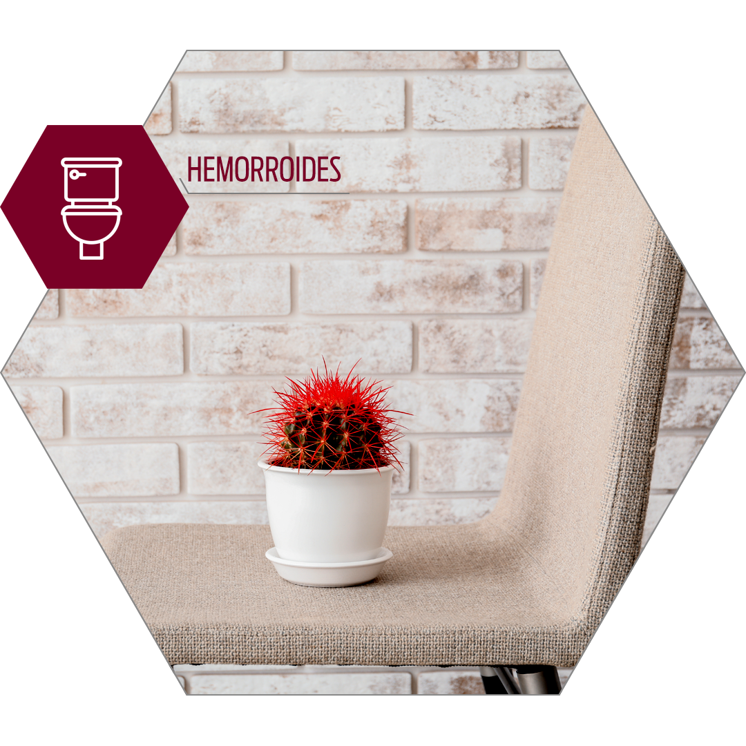 Hemorroides